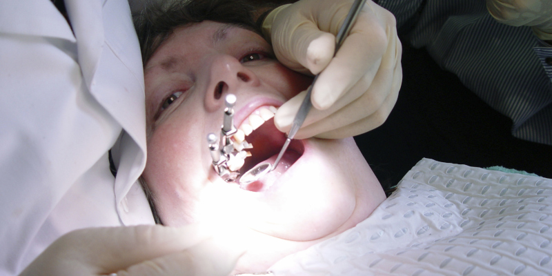 Wisdom Tooth Extraction in Lakeland, Florida