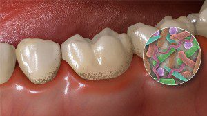 Dental Health Advice: How Teeth Can Affect the Entire Body