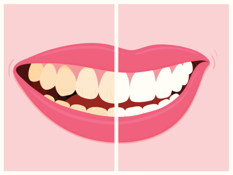 5 Foods That Could Be Staining Your White Teeth