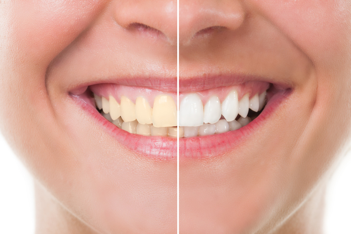 Healthy Teeth Start With Excellent Dental Services