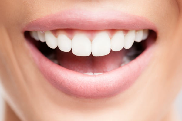 3 Things to Note Before You Go For Teeth Whitening