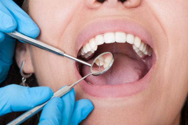 How to Care for Your Teeth Between Dentist Checkups