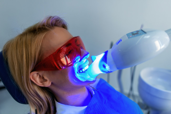 How Tooth Whitening Works