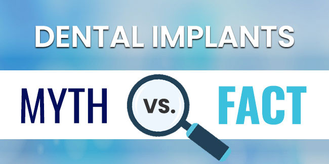 Common Myths About Dental Implants [infographic]