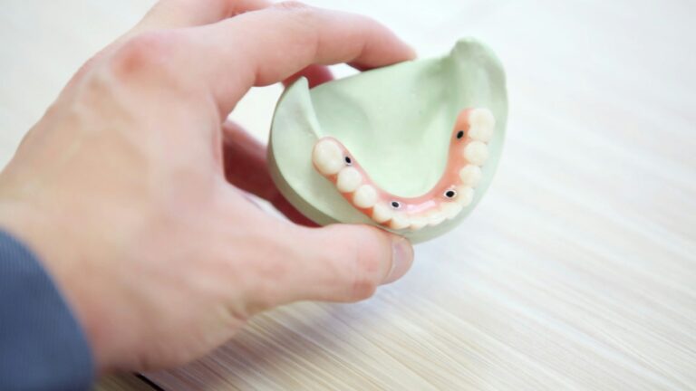 Understanding Tooth Loss and Its Impact on Oral Health