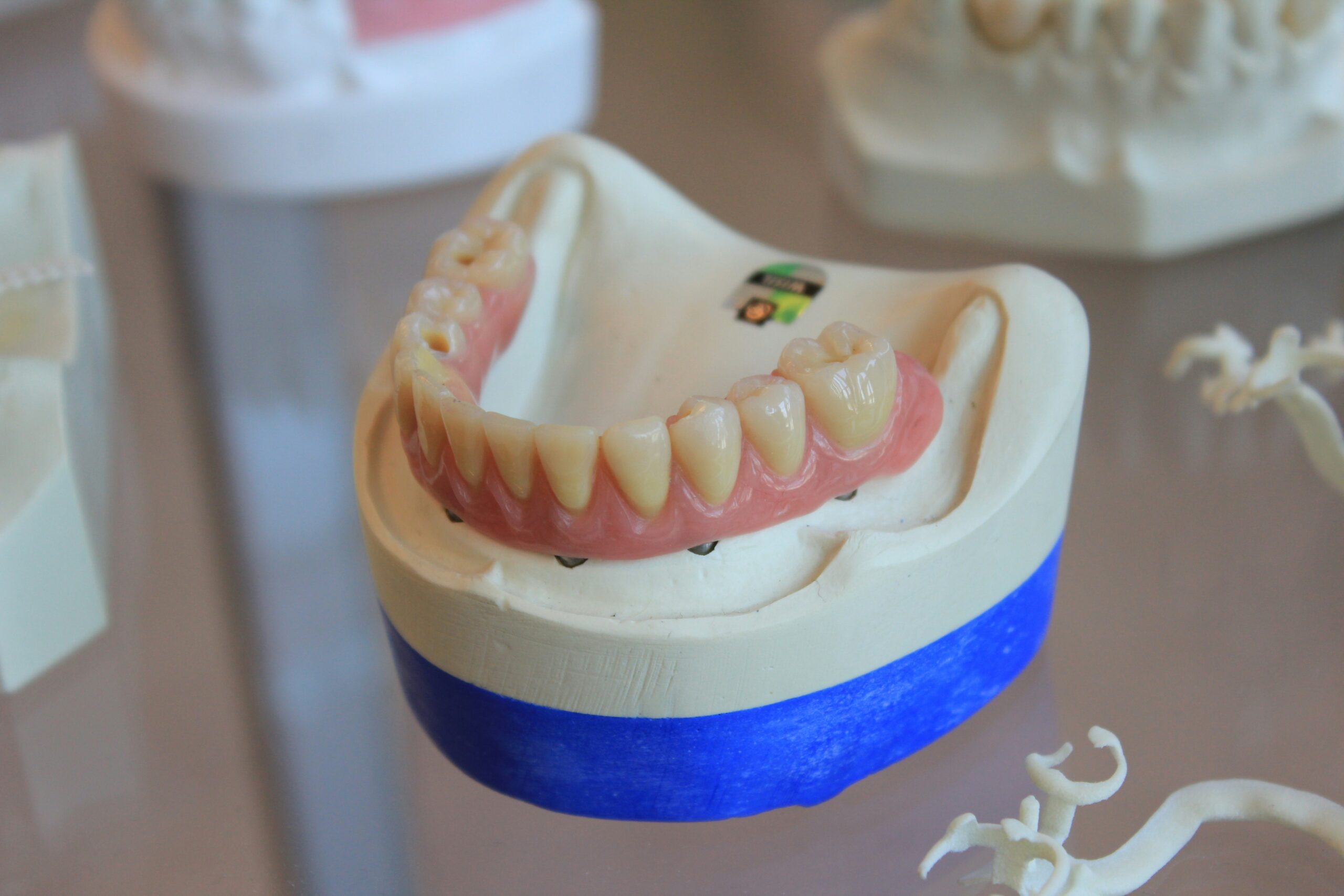 Dental Fillings: Everything You Need to Know for a Healthy Smile