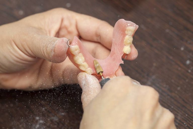 how can i make my own dentures at home?