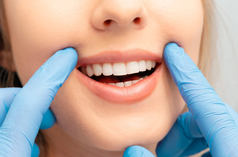 Why Choose a Dentist for Tooth Whitening in Lakeland, Florida, Instead of DIY Kits?
