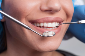 Tooth Whitening