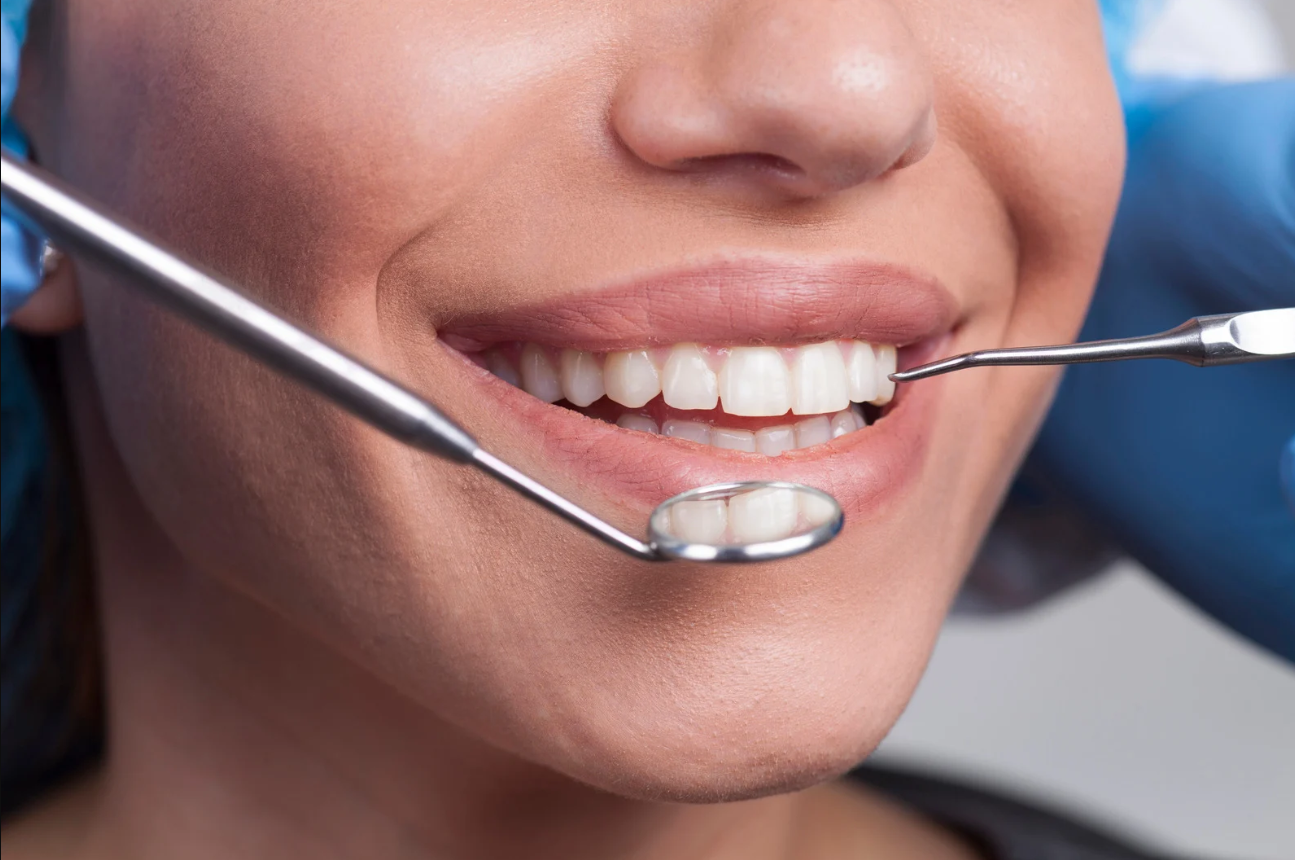 Why Should You Consider Tooth Whitening Instead of DIY Kits in Lakeland, FL?