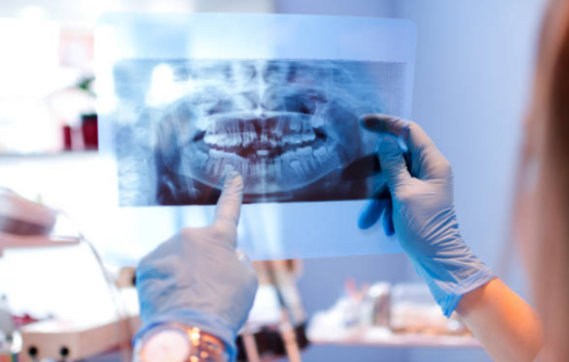 Dental X-ray cost in North Lakeland, FL explained with dental X-ray information and pricing factors.