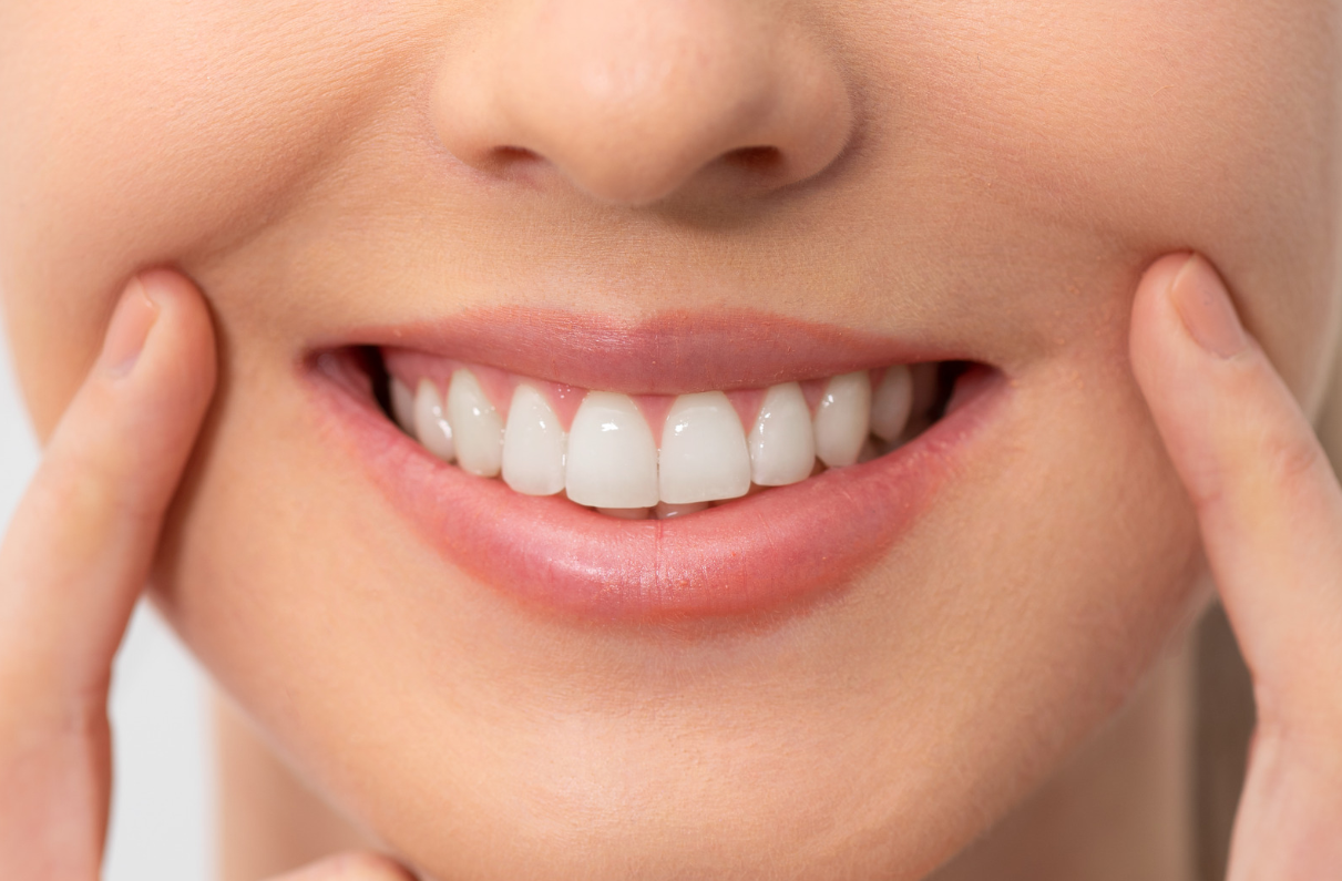 What Affects the Cost of Professional Teeth Whitening?